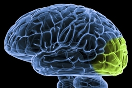 Some regions of the visual cortex, highlighted here, can be rewired to process sound in the brains of people born blind.