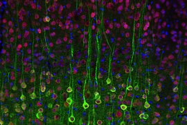 MIT neuroscientists used calcium imaging to label these pyramidal cells in the brain.