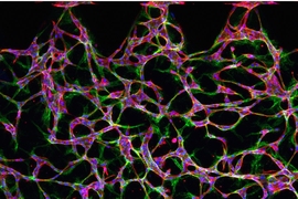 A microscopic image of endothelial cells suspended in a central region of a microfluidic device, showing the initial stages in the formation of a network of vessels.