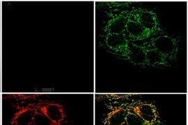 micrographs of cells