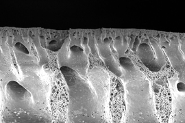 Pictured is a scanning electron micrograph of a porous, nanostructured poly(lactic-co-glycolic acid) (PLGA) membrane. The membrane is coated with a polyelectrolyte (PEM) multilayer coating that releases growth factors to promote bone repair.