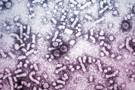 An electron micrograph shows the presence of hepatitis-B virus.