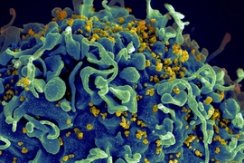 This human T cell (blue) is under attack by HIV (yellow), the virus that causes AIDS. The virus specifically targets T cells, which play a critical role in the body's immune response against invaders like bacteria and viruses.