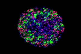 A glucose-stimulated insulin, derived from stem cells, producing cells. 