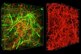 A new technique called magnified analysis of proteome (MAP), developed at MIT, allows researchers to peer at molecules within cells or take a wider view of the long-range connections between neurons.
