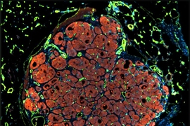 Researchers have developed a new way to engineer liver tissue by organizing tiny subunits that contain three types of cells embedded into a biodegradable tissue scaffold. This image shows vascularized engineered human liver tissue that has self-organized into a lobule-like microstructure.
