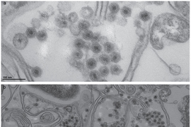 Electron microscope images of marine bacteria infected with the non-tailed viruses studied in this research. The bacterial cell walls are seen as long double lines, and the viruses are the small round objects with dark centers.
