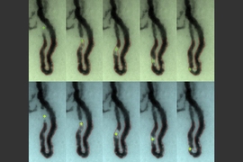 MIT researchers have developed a way to measure white blood cell levels by imaging the cells as they flow through capillaries at the base of the fingernail. In these images, the white blood cells are marked by crosses.