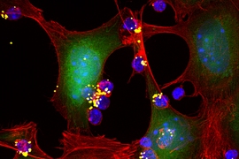 MIT engineers have designed nanoparticles that can be attached to T cells and release T-cell-stimulating molecules called cytokines (yellow spheres).  These cytokines activate T cells (blue) to attack nearby tumor cells.