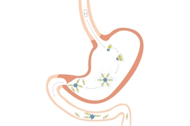 After being swallowed, the capsule unfolds and slowly releases its drug payload in the stomach. After a few weeks, it breaks down and moves through the digestive tract.