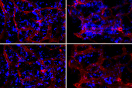 RNAi nanoparticles inside bone marrow