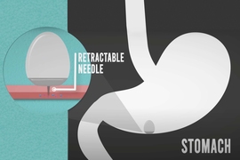 diagram of antibodies entering stomach