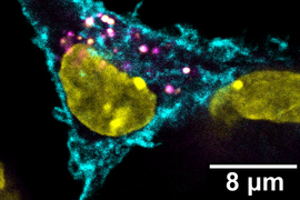 t cells attacking tumor