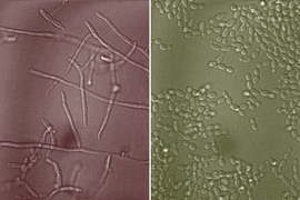 the yeast Candida albicans and mucin glycans