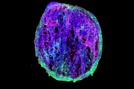 forebrain spheroid scan